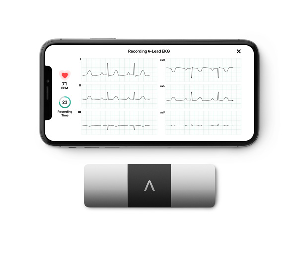 Domowe EKG